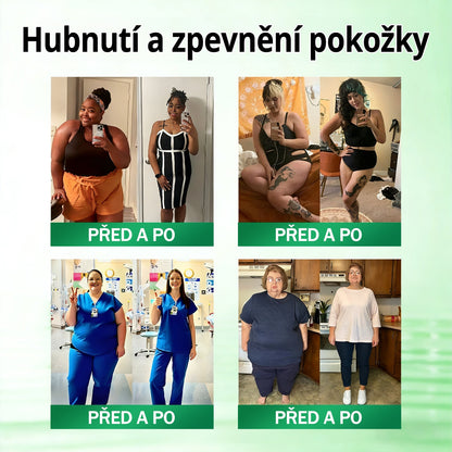 🧑‍⚕️ Oficiální obchod | 💯 PZGONE® Moringa·Berberine×NAD+ 10v1 Náplast (Okamžitý účinek, 7 dní viditelná transformace)✅ Řešení pro: Obezita, ochablá pokožka, diabetes, spánková apnoe, kloubní potíže.